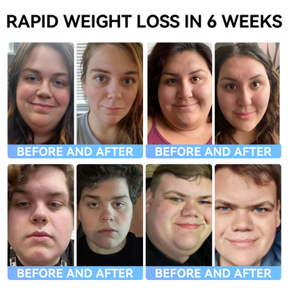 ✅Official Store：𝑺𝐩𝐳𝐯™ 🐼𝐌𝐞𝐠𝐥𝐮𝐭𝐢𝐝𝐞 𝐨𝐫𝐚𝐥 𝐥𝐢𝐪𝐮𝐢𝐝 (A food-grade fat-burning product developed by Albert Einstein College of Medicine and highly recommended by USP!)