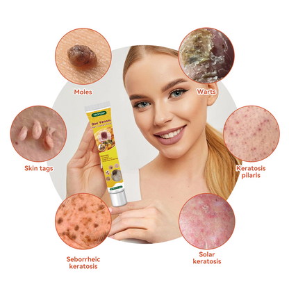 𝐅𝐑𝐎𝐏𝐔𝐍™ 💎 𝐁𝐞𝐞 𝐕𝐞𝐧𝐨𝐦 𝐖𝐚𝐫𝐭 𝐓𝐫𝐞𝐚𝐭𝐦𝐞𝐧𝐭 𝐂𝐫𝐞𝐚𝐦 (👨‍⚕️𝐀𝐀𝐃 𝐑𝐄𝐂𝐎𝐌𝐌𝐄𝐍𝐃𝐒)