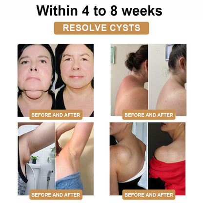 💕💕 SCNDR™ Ultrasonic Cellulite Removal and Detoxification Wristband (30% off for a limited time + 👩‍⚕️doctor's recommendation)