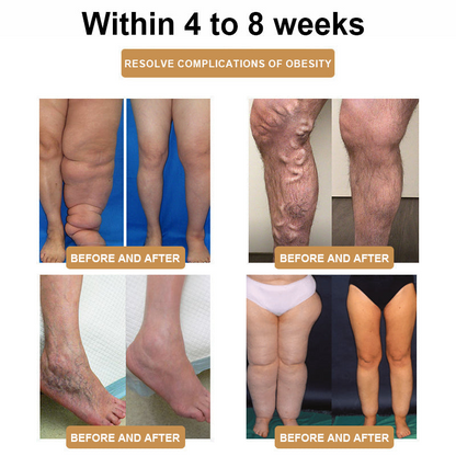 💕💕 SCNDR™ Ultrasonic Cellulite Removal and Detoxification Wristband (30% off for a limited time + 👩‍⚕️doctor's recommendation)