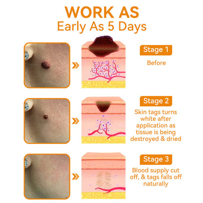 💕💕𝐅𝐑𝐎𝐏𝐔𝐍™ 𝐁𝐞𝐞 𝐕𝐞𝐧𝐨𝐦 𝐖𝐚𝐫𝐭 𝐓𝐫𝐞𝐚𝐭𝐦𝐞𝐧𝐭 𝐂𝐫𝐞𝐚𝐦 (👨‍⚕️𝐀𝐀𝐃 𝐑𝐄𝐂𝐎𝐌𝐌𝐄𝐍𝐃𝐒)