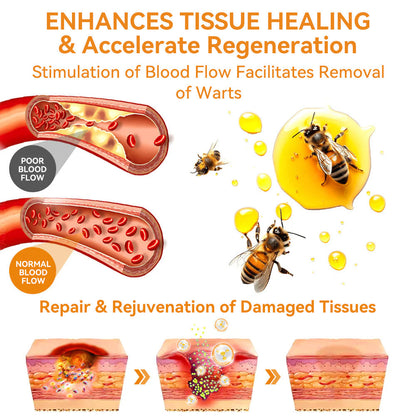 💕💕𝐅𝐑𝐎𝐏𝐔𝐍™ 𝐁𝐞𝐞 𝐕𝐞𝐧𝐨𝐦 𝐖𝐚𝐫𝐭 𝐓𝐫𝐞𝐚𝐭𝐦𝐞𝐧𝐭 𝐂𝐫𝐞𝐚𝐦 (👨‍⚕️𝐀𝐀𝐃 𝐑𝐄𝐂𝐎𝐌𝐌𝐄𝐍𝐃𝐒)