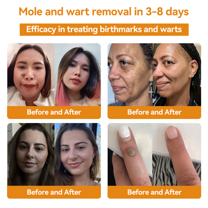 💕💕𝐅𝐑𝐎𝐏𝐔𝐍™ 𝐁𝐞𝐞 𝐕𝐞𝐧𝐨𝐦 𝐖𝐚𝐫𝐭 𝐓𝐫𝐞𝐚𝐭𝐦𝐞𝐧𝐭 𝐂𝐫𝐞𝐚𝐦 (👨‍⚕️𝐀𝐀𝐃 𝐑𝐄𝐂𝐎𝐌𝐌𝐄𝐍𝐃𝐒)