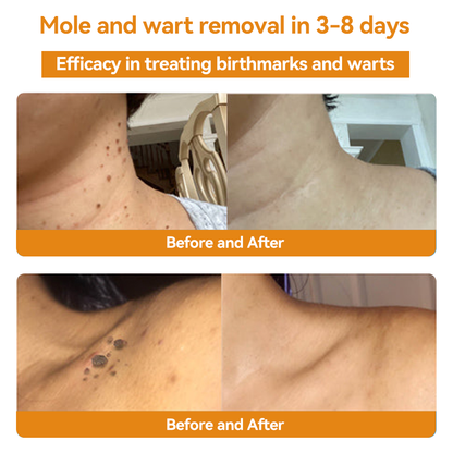 💕💕𝐅𝐑𝐎𝐏𝐔𝐍™ 𝐁𝐞𝐞 𝐕𝐞𝐧𝐨𝐦 𝐖𝐚𝐫𝐭 𝐓𝐫𝐞𝐚𝐭𝐦𝐞𝐧𝐭 𝐂𝐫𝐞𝐚𝐦 (👨‍⚕️𝐀𝐀𝐃 𝐑𝐄𝐂𝐎𝐌𝐌𝐄𝐍𝐃𝐒)
