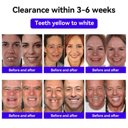 𝐅𝐀𝐓𝐎𝐍𝐆™ 𝐢𝐧𝐭𝐞𝐥𝐥𝐢𝐠𝐞𝐬𝐦𝐢𝐥𝐞 𝐁𝐞𝐞 𝐕𝐞𝐧𝐨𝐦 𝐓𝐫𝐞𝐚𝐭𝐦𝐞𝐧𝐭 𝐓𝐨𝐨𝐭𝐡𝐩𝐚𝐬𝐭𝐞🐼🐼（𝐒𝐮𝐢𝐭𝐚𝐛𝐥𝐞 𝐟𝐨𝐫 𝐚𝐥𝐥 𝐝𝐞𝐧𝐭𝐚𝐥 𝐚𝐧𝐝 𝐨𝐫𝐚𝐥 𝐩𝐫𝐨𝐛𝐥𝐞𝐦𝐬）