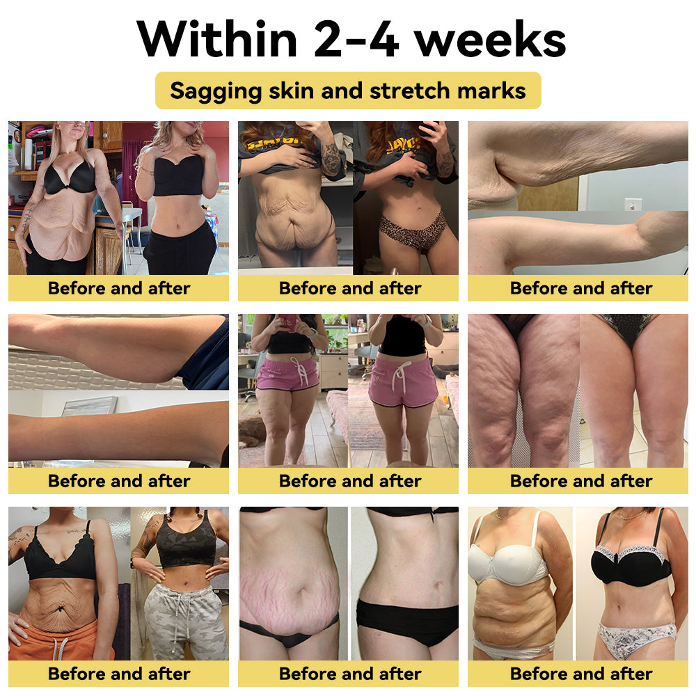 💧SPZV™ Bee Venom Turmeric Detox Slimming Cream（For all obesity and lymphatic problems）