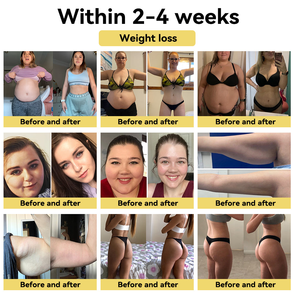 💧SPZV™ Bee Venom Turmeric Detox Slimming Cream（For all obesity and lymphatic problems）