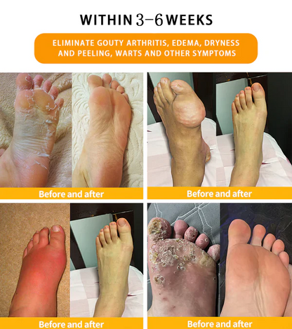 Bostore™🎁 30-Herb Slimming & Detox Foot Bath Beads🍃🍃-- (LANA Certification, British Lymphatic Association)